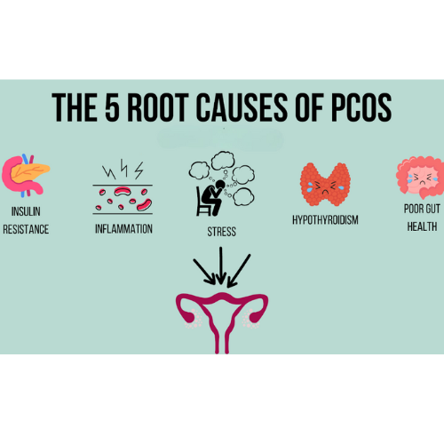Stress and poor diet as major causes of PCOS in young women