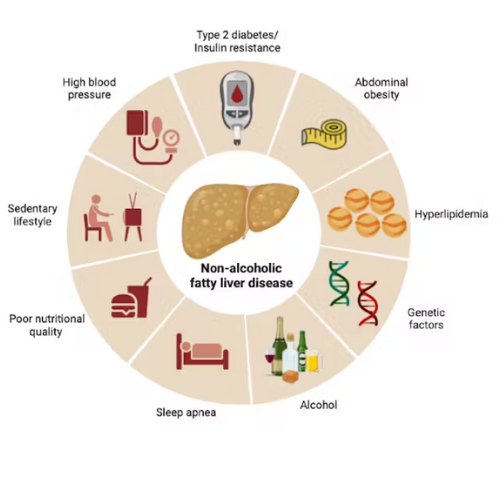various factors causing non-alcoholic fatty liver